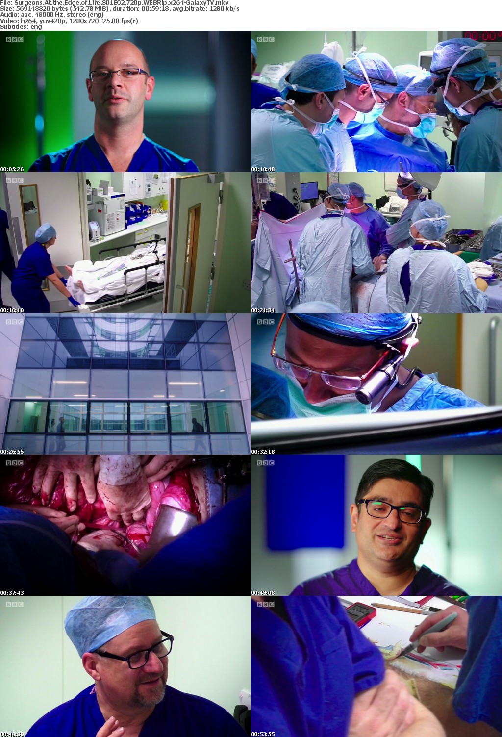 Surgeons At The Edge Of Life S01 COMPLETE 720p WEBRip x264-GalaxyTV